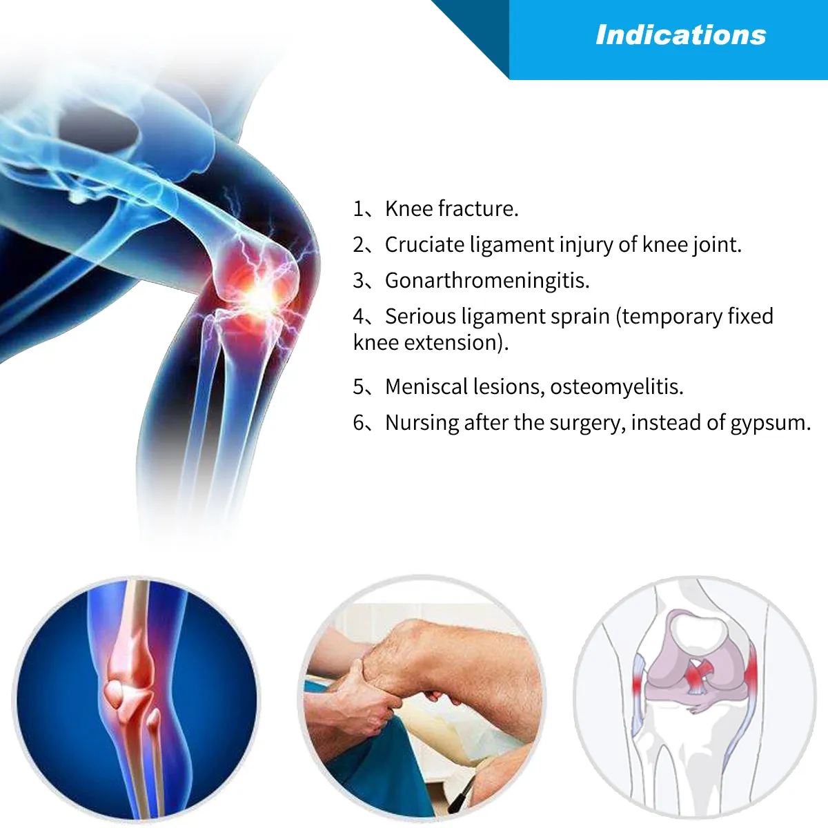 Knee Immobilizer - Tri-panel Version